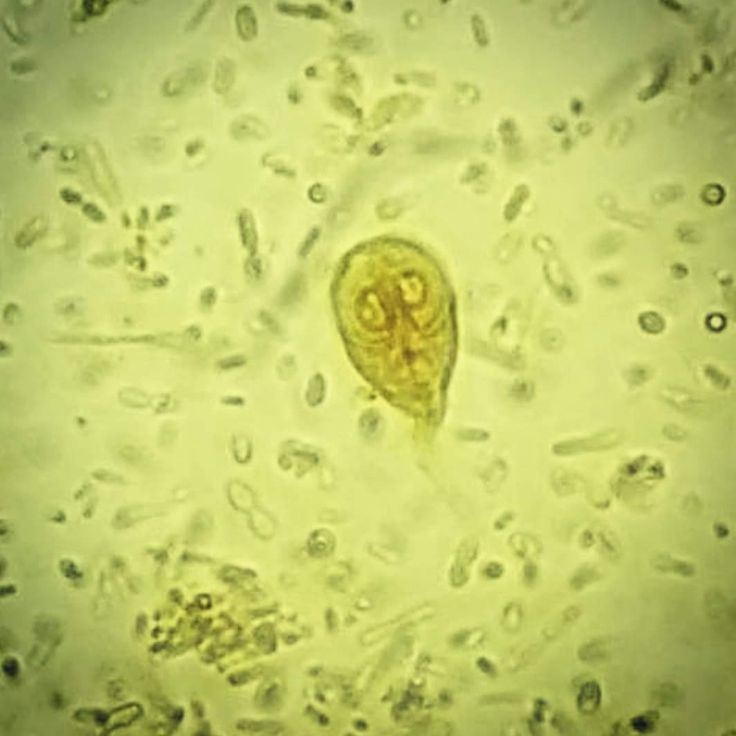 giardia dog poop picture 